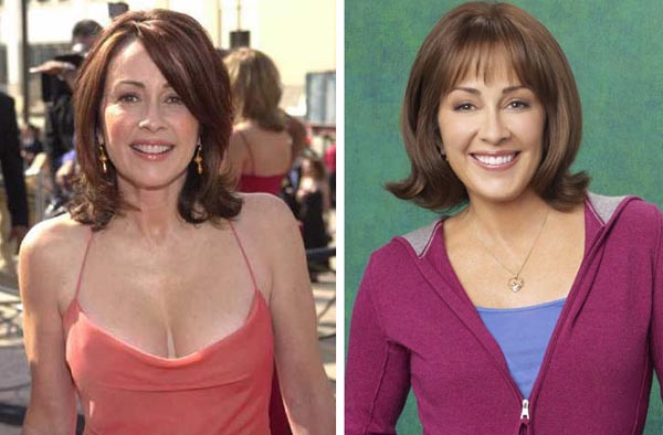 Patricia Heaton Plastic Surgery Before & After