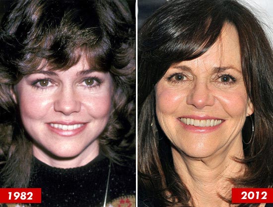 Sally Field Plastic Surgery Before & After