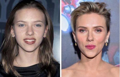 Scarlett Johansson Plastic Surgery