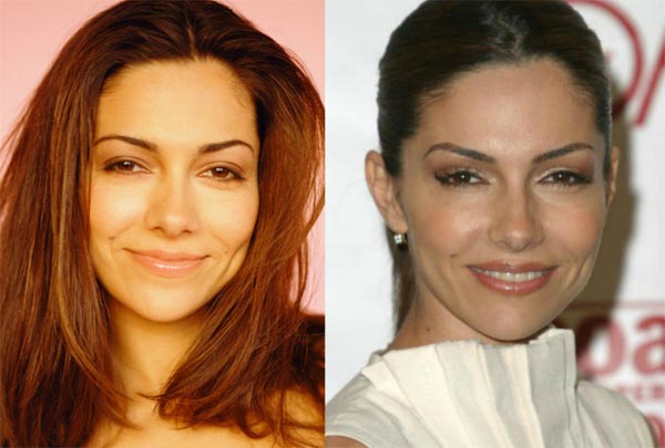 Vanessa Marcil Plastic Surgery Before & After