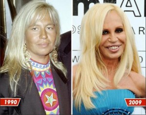 Celebrity Plastic Surgery Gone Wrong Before After Plastic Surgery Talks