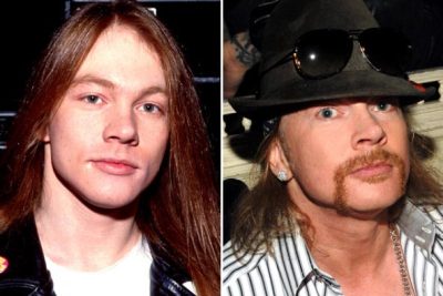 Axl Rose Plastic Surgery Before & After - Plastic Surgery Talks