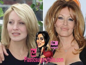 Linda Kozlowski Plastic Surgery Before & After ...