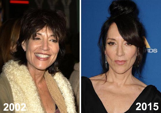 Katey Sagal is one of the many celebrities who have heard their faces chang...