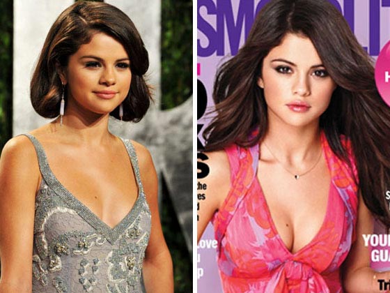 Selena Gomez Plastic Surgery The Boob Job Reveal Plastic Surgery Talks
