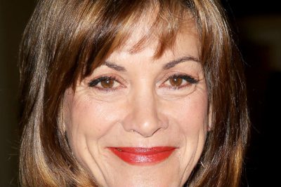 Wendie Malick Plastic Surgery