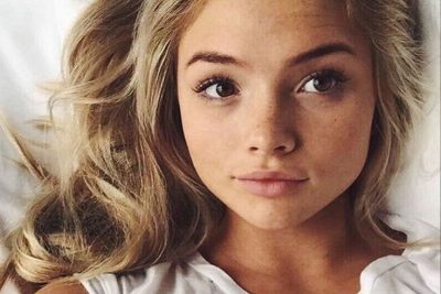 Natalie Alyn Lind Plastic Surgery