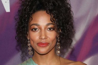 Kylie Bunbury Cosmetic Surgery