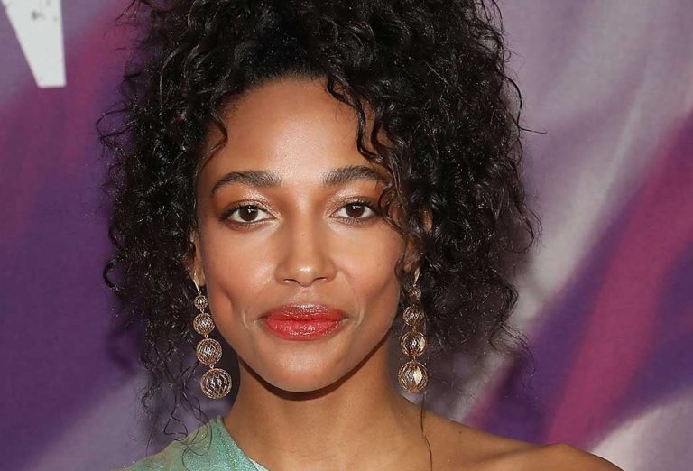 Kylie Bunbury Cosmetic Surgery