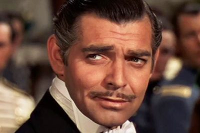 Clark Gable Cosmetic Surgery