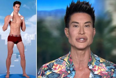 Justin Jedlica Plastic Surgery